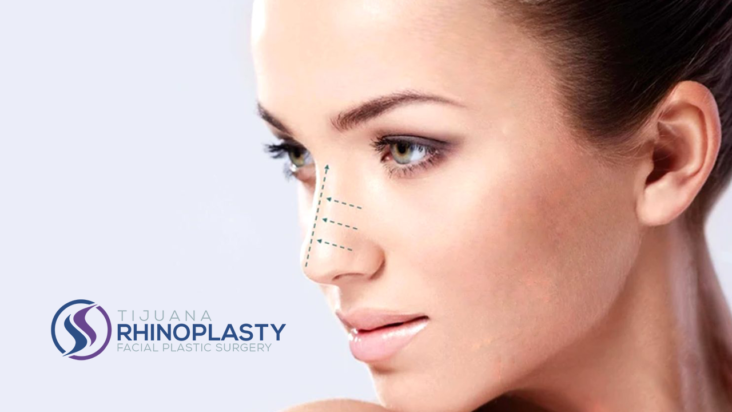 Rhinoplasty surgery improves the form (shape) and function (breathing) of the nose. Find out if you are a good rhinoplasty candidate.