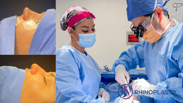 Tijuana rhinoplasty specialist, Dr. Edgar Eduardo Santos’ specialized training and experience allow him to take on the most demanding and unusual cases. 