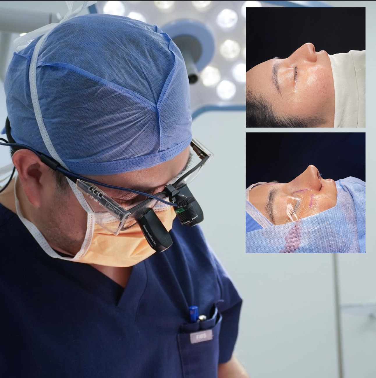 Tijuana Rhinoplasty offering world class facial plastic surgery, specializing in Rhinoplasty by Dr. Edgar Eduardo Santos.