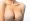 Breast augmentation in Tijuana, Mexico is surgery to increase breast size. It’s also called augmentation mammoplasty. It involves placing breast implants under breast tissue or chest muscles.