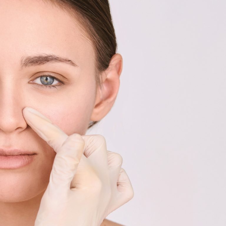 The different types of rhinoplasty surgery include open rhinoplasty and closed rhinoplasty, each suited for specific goals.